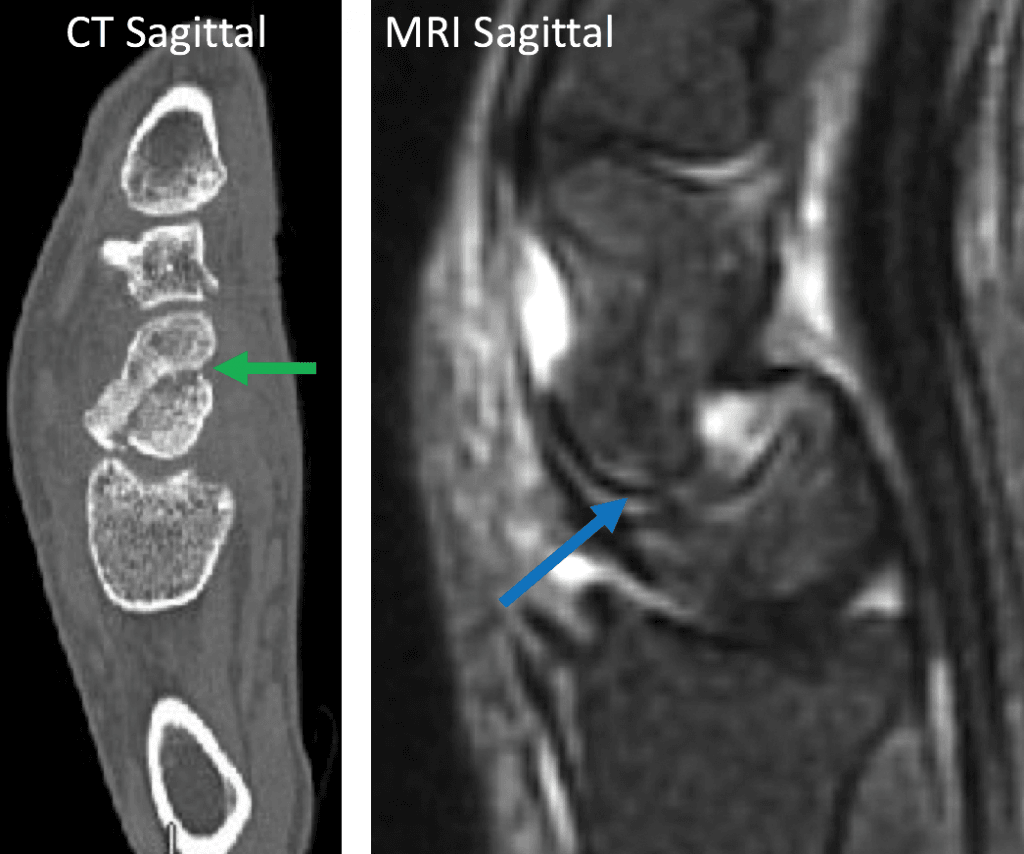 CT and MRI sagittal images